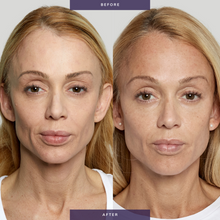Load image into Gallery viewer, Sculptra (Service)
