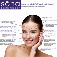 Load image into Gallery viewer, BOTOX® By The Unit (Service)
