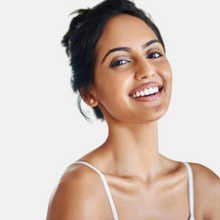 Load image into Gallery viewer, SkinPen® Microneedling
