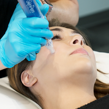 Load image into Gallery viewer, SkinPen® Microneedling
