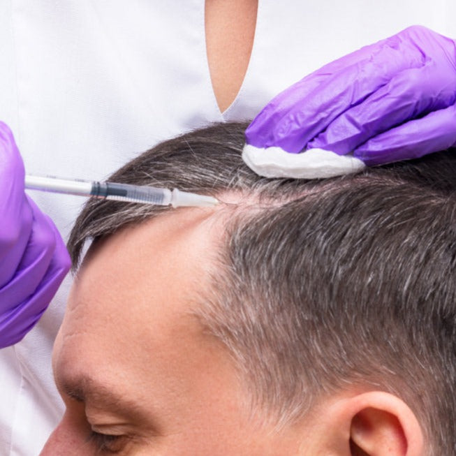 Hair Loss Scalp Injections  (Service)